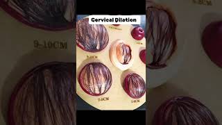 Cervical Dilation trending pregnant cervix cervical dilation [upl. by Amorete]