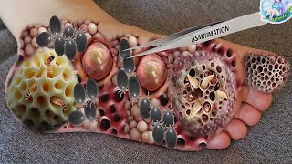 ASMR Infected Foot Treatment Animation Dog Tick amp Maggot Removal  Deep Cleaning Animation [upl. by Anai]