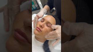 BioRePeel  Mit Liebe zum Detail Kosmetiksalon Berlin shortvideo biorepeel skincare [upl. by Notelrac]