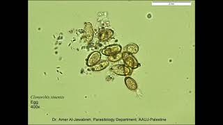 Clonorchis sinensis Eggs [upl. by Eittol]