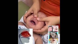 How to clear your stuffy nose in one minute parentingmethod baby [upl. by Fanchette]