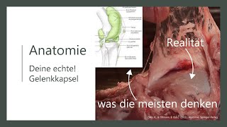 Gelenkkapsel  Was die meisten denken und wie es wirklich ist [upl. by Prudhoe529]