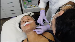 Beauty maintenance Vlog  Lip injections botox jawline filler teeth whitening  Self Care botox [upl. by Luar334]