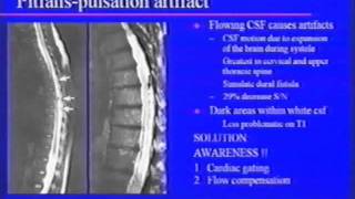 Neuroimaging of Transverse Myelitis Current and Future [upl. by Tupler332]