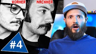 Libidoverlust durch Minoxidil und Erfolge  Bartwuchs Info Check Folge4 [upl. by Kleeman]