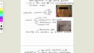 MRCP PACES CARDILOGY STATION MITRAL STENOSIS [upl. by Jonell11]