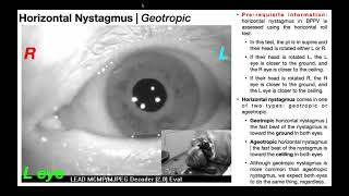 Nystagmus EXPLAINED 👀  Visualizing amp Interpretation [upl. by Gautious76]