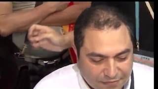 Caboki Hair Fibers Demonstration Results Hair loss Easy Hack  HairFiberZcom [upl. by Skolnik575]