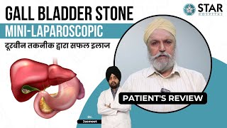 Best Hospital for Gall Bladder Stone in Phagwara  Best Gall Bladder Doctor  Gall Bladder Treatment [upl. by Anilac76]