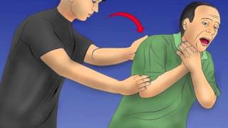 How to do the Heimlich Maneuver [upl. by Nickolas953]