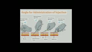 💉How to select angles of administration of injection aiims injection meditutor [upl. by Inanuah]