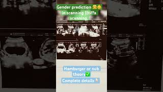 gender prediction👶👧 symtoms tiffa scanninggenderprediction ytshorts 😅 [upl. by Largent]