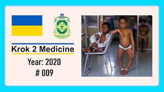 Krok 2 Medicine  Year 2020  009 Ministry of Public Health of Ukraine [upl. by Nosnev549]