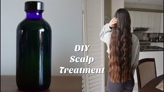 DIY Scalp Treatment for Hair Growth [upl. by Rori]