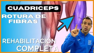 Rotura de fibras de CUADRICEPS🔥🔥👉🏼Ejercicios de REHABILITACIÓN DE CUÁDRICEPS [upl. by Beaufort]