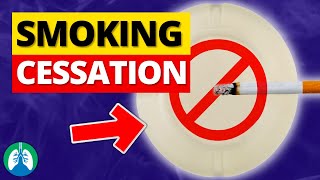 Smoking Cessation  Helping Patients Quit Smoking [upl. by Ydrah]