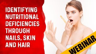 Identifying Nutritional Deficiencies Through Nails Skin amp Hair – DrBergs Webinar [upl. by Ppik]