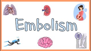 Embolism  Definition Types of Embolism amp Clinical Manifestations [upl. by Akemahs]