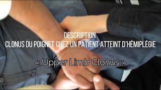 Clonus du poignet chez les patients un atteint d’hémiplégie « Upper Limb Clonus » [upl. by Laurel953]