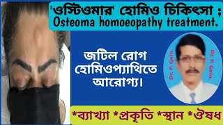 736 ওস্টিওমার হোমিওপ্যাথি চিকিৎসা  Osteoma homoeopathy treatment [upl. by Greenwell]