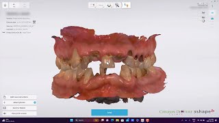 ICUDICPLD Intraoral Scans [upl. by Dasteel270]