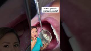 ¿Sabías que el rechinar los dientes puede causar agujeros 😱🦷 [upl. by Huberto516]