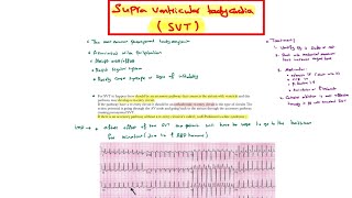 Supraventricular tachycardia  Multifocal atrial tachycardia [upl. by Uolyram]