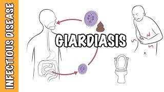 Giardiasis  Giardia Lamblia Giardia intestinalis Giardia duodenalis infection [upl. by Eirameinna]