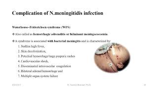 Neisseria meningitidis [upl. by Uthrop]