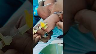 Infant Cannula insertion😱🔥😡safecaretrending motivation [upl. by Marriott]