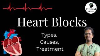 Heart Blocks Types Causes ECG findings Treatment [upl. by Ayokal]