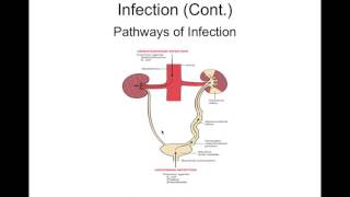 Chapter 27 Intrarenal Disorders BIOL300 [upl. by Esiuqcaj170]