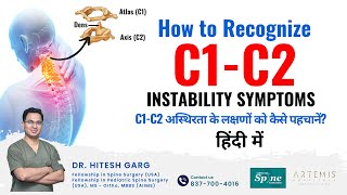 How to recognize C1C2 instability symptoms Ask Best Spine Surgeon in India  Spine Doc in Gurgaon [upl. by Innavoj]