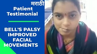 Bells Palsy Patient Recovery Feedback Post Physiotherapy Treatment  leadphysiocom [upl. by Solracnauj]