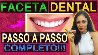 Aula 2  Técnica INFALÍVEL de como fazer uma Faceta Direta em Resina no Consultório 27 [upl. by Nywg]