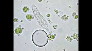 Algae Euglena 400x magnification [upl. by Gildus]