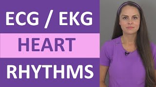 EKG Rhythms  ECG Heart Rhythms Explained  Comprehensive NCLEX Review [upl. by Madora]