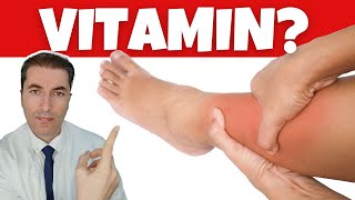 No1 vitamin for removing leg and foot SWELLING [upl. by Kynan]