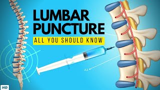 Lumbar Puncture Everything You Need to Know [upl. by Aihsoj710]