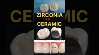 ZIRCONIA vs PFM CROWN is equal to ELEGANCE vs TRADITIONAL CHARM dental zirconia trending smile [upl. by Benjie]