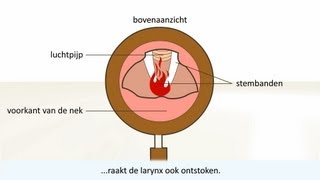 Keelontsteking  de oorzaak en behandeling [upl. by Weibel986]