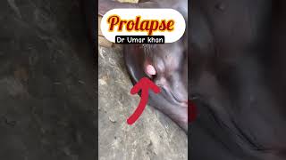 Prolapse l dr Umar khan [upl. by Ferreby]