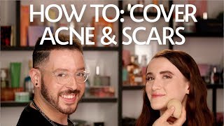 How To Cover Acne amp Scars  Sephora [upl. by Adnuhsed581]