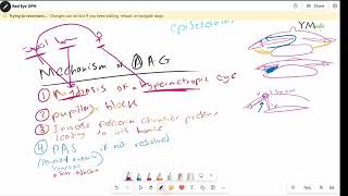 Red Eye 3 iridocyclitis amp ACG OPH [upl. by Schmidt]