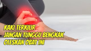 Cara mengatasi keseleo dan kaki terkilir [upl. by Cilka]