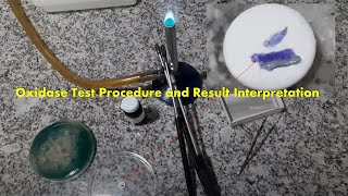 Oxidase Test Positive Procedure Result and Interpretation [upl. by Ole]