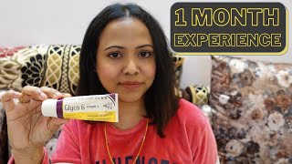 Clindamycin amp Nicotinamide Gel Glocin Gel Review In Hindi [upl. by Shanan]