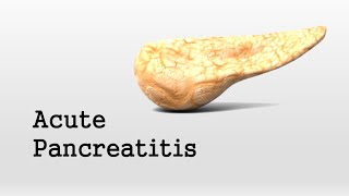 Acute Pancreatitis [upl. by Giacamo]