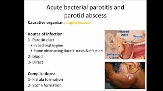 salivary gland infections [upl. by Menendez]