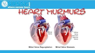 Heart Murmurs  AorticMitral Stenosis Regurgitation  How to identify [upl. by Barncard384]